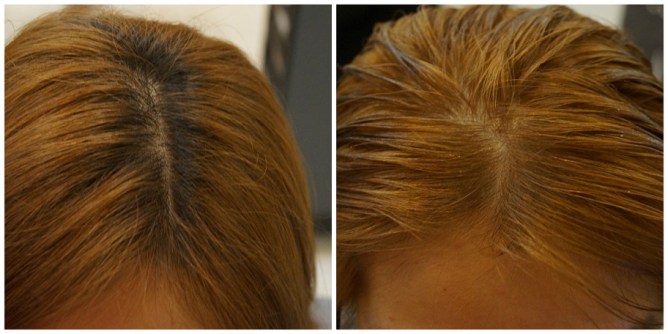 010before and after